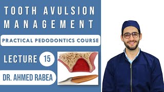 Lecture 15  Tooth Avulsion Management  كورس بيدو عملي [upl. by Hairehcaz]