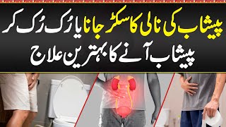 Peshab Ki Nali Sukar Jana or Ruk Ruk Kar Urine Ana Urethral Stricture Disease Symptoms amp Treatment [upl. by Ahsiekrats]