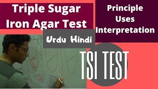 TSI Test  Triple Sugar Iron Test  Understand Easily [upl. by Nosnar]