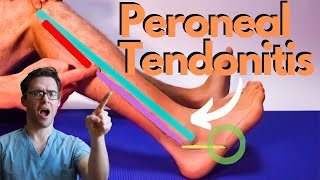 Peroneal Tendonitis Treatment 2024 Peroneus Brevis amp Longus Pain [upl. by Fries]