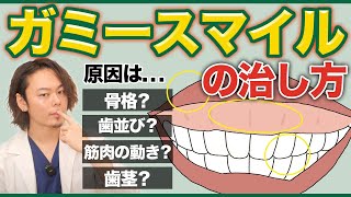 ガミースマイルの治し方・原因について美容外科医が解説！！【コンプレックス解消】 [upl. by Sivrat]