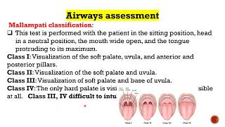 Endotracheal Intubation [upl. by Notgnirra572]