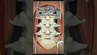 Lumbar Discectomy Surgery Medical Animation [upl. by Sillig]