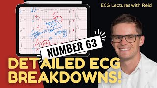 EKG Test Yourself  ECG Case Study 63 [upl. by Aramoy639]