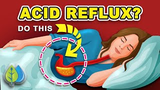 3 Ways to Stop ACID REFLUX Naturally  How to Stop Acid Reflux amp HEARTBURN [upl. by Ianej]