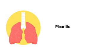 Rippenfellentzündung Pleuritis  Erkrankungen der Atemwege [upl. by Liahcim]