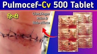 Pulmocef Cv 500 Tablet  Cefuroxime axetil Tablets Review in Hindi  by Mt discuss [upl. by Jedidiah]