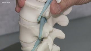 New procedure gives instant relief for spinal stenosis [upl. by Hump]