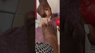 My toe nails look too fat until  African Diaspora Lens pedicure [upl. by Lleryt]