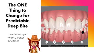 Invisalign ClinCheck  The 1 Thing to do for Deep Bite predictability [upl. by Kling]