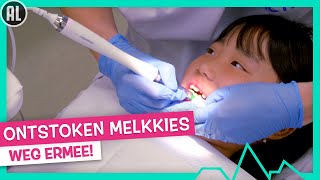 ONTSTOKEN MELKKIES TREKKEN 🦷  TOPDOKS [upl. by Ellan]