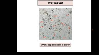 Stool Analysis 15 Cryptosporidium  Floatation  MZN الطفيليات الإنتهازية [upl. by Osterhus]