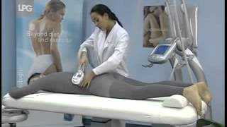 LPG Endermologie treatment demo  Salon House  London [upl. by Aneele]