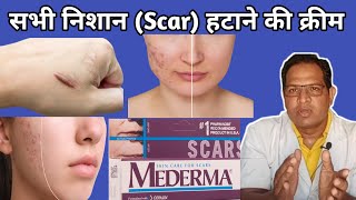 mederma cream  Mederma for acne scars  Mederma Advanced scar gel review [upl. by Paulette72]