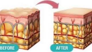 Does Plant Based Phytoceramindes Work [upl. by Neivad]