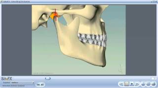 Anterior Guidance [upl. by Schilt]