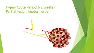 Nerve damage and repair [upl. by Jueta327]