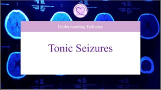 What are Tonic Seizures [upl. by Hengel]