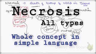 Necrosis Types and MechanismGeneral pathology Necrosis Pathology [upl. by Ellessig]