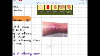 General pathology  inflammation 1 [upl. by Junna]