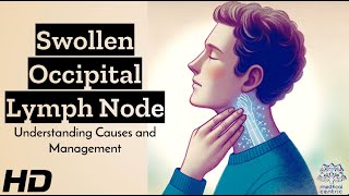 Swollen Occipital Lymph Node Whats Behind It [upl. by Salina]