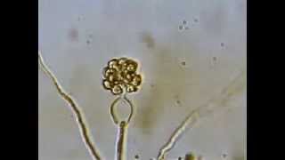 Release of Zoospores by Pythium [upl. by Vincelette]