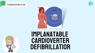 ICD Implantable Cardioverter Defibrillator [upl. by Einaled]