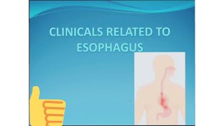 CLINICLALS RELATED TO THE ESOPHAGUSBarium swallowAchalasia CardiaDysphagiaEsophageal carcinoma [upl. by Odlonra]