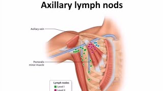 Lymphatic drainage of breast [upl. by Tallia]