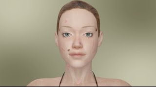 10 Ways To Remove Facial Skin Lesions [upl. by Urbas]