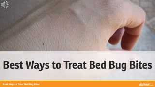 Best Ways to Treat Bed Bug Bites [upl. by Vargas]