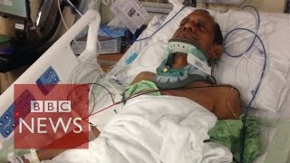 Indian injured by US police speaks out  BBC News [upl. by Zsamot]