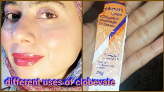 Clobevate cream for whitening  zartasha zar  clobevate cream [upl. by Pearlstein]