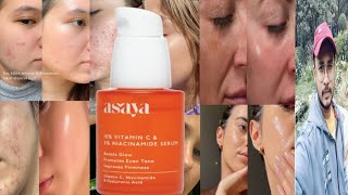 Asaya 10 Vitamin C Serum  Honest Review [upl. by Llerret]