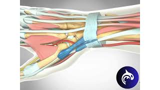 Quick View  De Quervain’s Tenosynovitis Release  3D Animation [upl. by Tnilc]