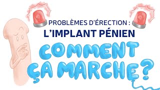 Problème dérection  Découvrez limplant pénien gonflable  💡 Explications du Dr LipskerUrologue [upl. by Einberger376]