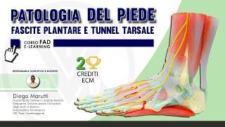 Presentazione del corso FAD quotApproccio Terapeutico a Fascite Plantare e Sindrome del Tunnel Tarsalequot [upl. by Dewhirst839]