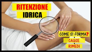 Ritenzione idrica cosè Come si forma Quali sono le cause e i rimedi [upl. by Elletnuahc28]