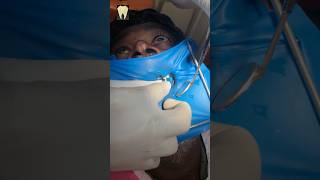 வலி இல்லா வேர் சிகிச்சை  Painless Root Canal [upl. by Webber]