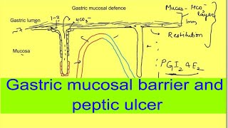 Gastric mucosal barrier and peptic ulcer  Gastrointestinal physiology mbbs 1st year lectures [upl. by Airdnalahs]