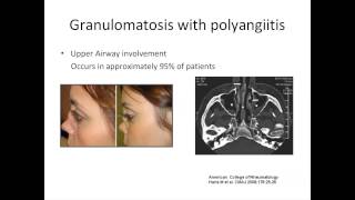 ANCA Vasculitis A Rheumatologists Perspective by Padmapriya Sivaraman MD [upl. by Llerdnek]