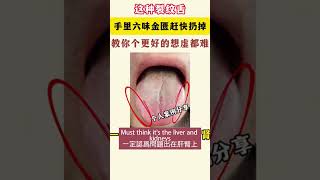 這種裂紋舌補腎藥趕快扔掉Throw away this fissured tongue kidney tonic medicine健康 养生 中醫傳承 health 科學養生 人生感悟 [upl. by Sorel]