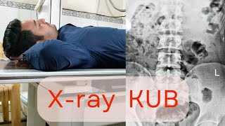 Xray KUB Positioning  Exposure  Measurements Digitising And Printing [upl. by Anawt]