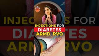 Eye Injections For Diabetes ARMD RVO [upl. by Diskson]