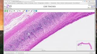 Hyaline cartilage histology demonstration [upl. by Brost]