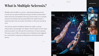 Multiple Sclerosis Fellowship class MK Sastry 02122024 Stroke neuroplasticity [upl. by Eceeryt908]