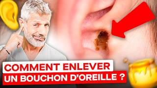 Comment Enlever un Bouchon de Cérumen  huile dolive bougies 😮 [upl. by Nnaeirual551]