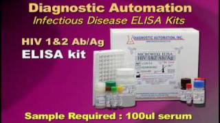 HIV1amp2 ELISA kit [upl. by Sheply559]