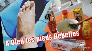 Dite a Dieu aux pieds rebelles en 5 jours [upl. by Iruam]