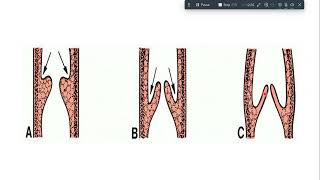 development of heart [upl. by Lorrin]